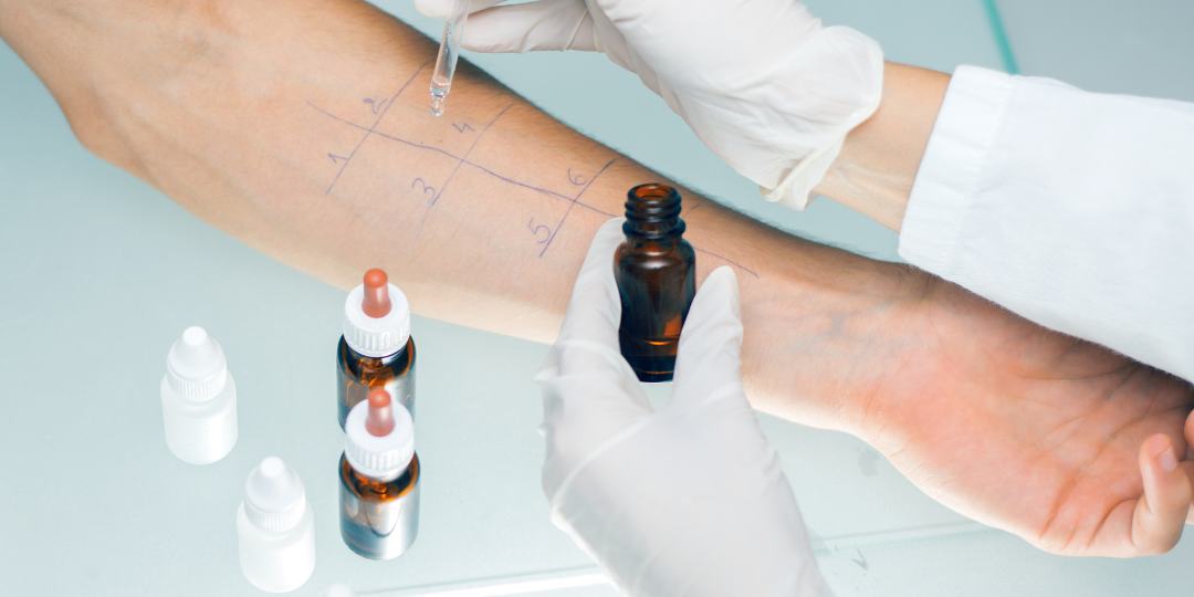 siti ALLERGOLOGIA PRICK TEST PATCH TEST BORRELLI PAOLO BACIC MICAELA centro medico jervis 22 poliambulatorio medico masso sport visita allergologica prick test patch test