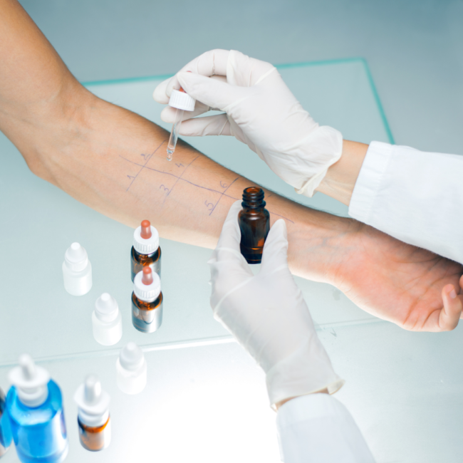 siti ALLERGOLOGIA PRICK TEST PATCH TEST BORRELLI PAOLO BACIC MICAELA centro medico jervis 22 poliambulatorio medico masso sport visita allergologica prick test patch test