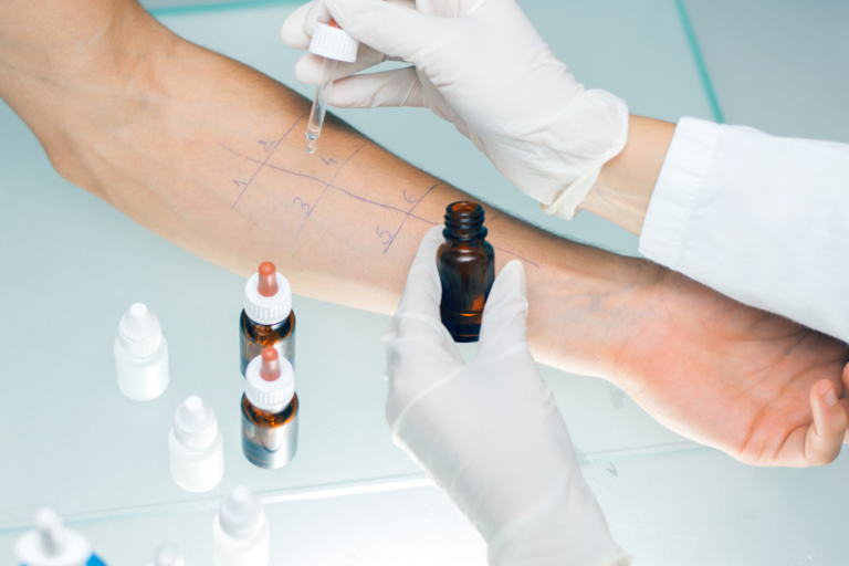 visita allergologica prick test patch test