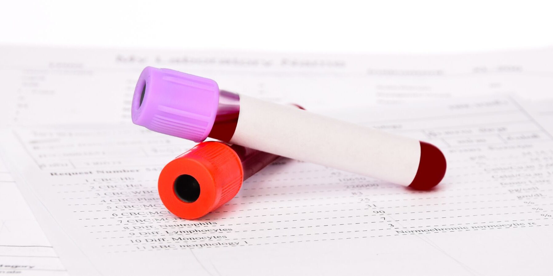 SITO analisi di laboratorio Jervis22 Ivrea Punto Prelievi Service AFFIDEA CDC Poliambulatori medici Jervis 22 Ivrea Masso Sport Oglianico