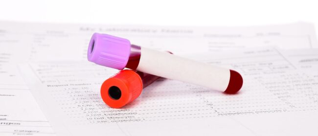 SITO analisi di laboratorio Jervis22 Ivrea Punto Prelievi Service AFFIDEA CDC Poliambulatori medici Jervis 22 Ivrea Masso Sport Oglianico