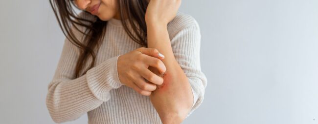 sito Dermatite atopica dermatologo Poliambulatori medici Jervis 22 Ivrea Masso Sport Oglianico