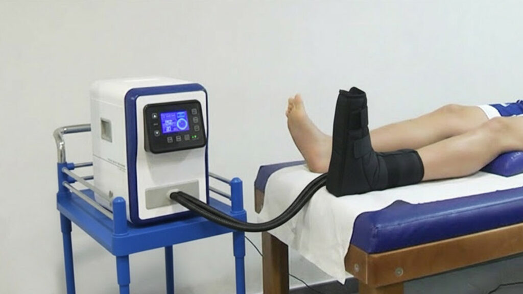 Crioterapia